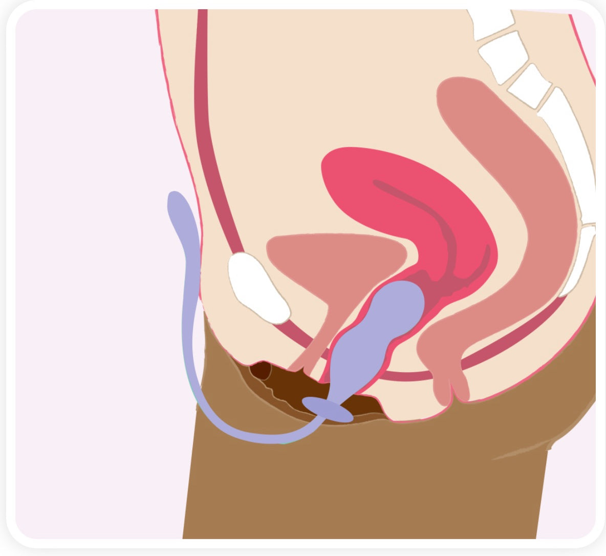 PERIFIT CARE+ inovatyvus dubens dugno treniruoklis